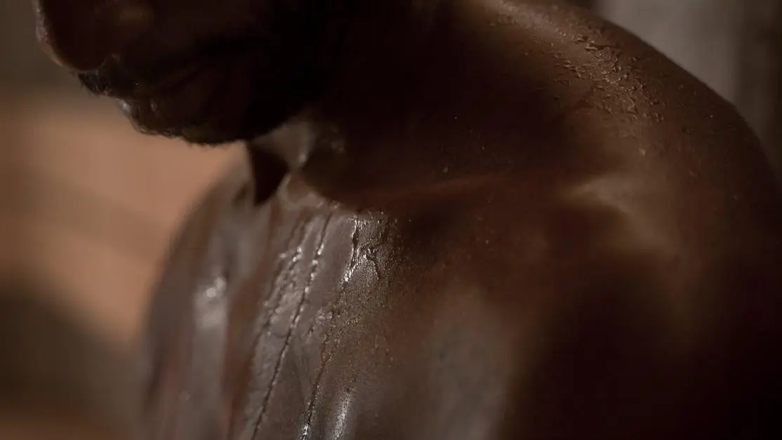 Shirtless adult male with sweat rash on chest and wet skin